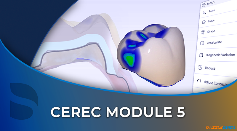 CEREC 05 Design and Manufacture