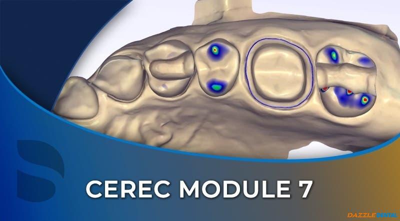 CEREC 07 Mastering Single-Tooth Restorations