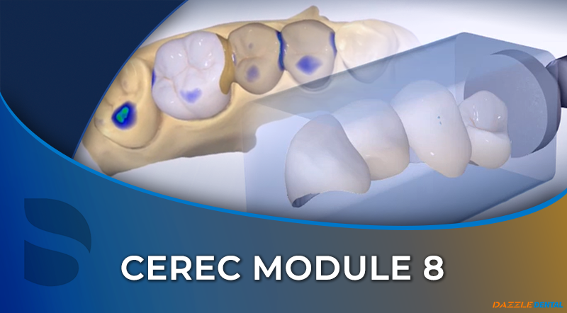 CEREC 08 Bridge Design