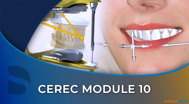 CEREC 10 Additional Functions – Surgical Guide, Smile Design, and Virtual Articulator