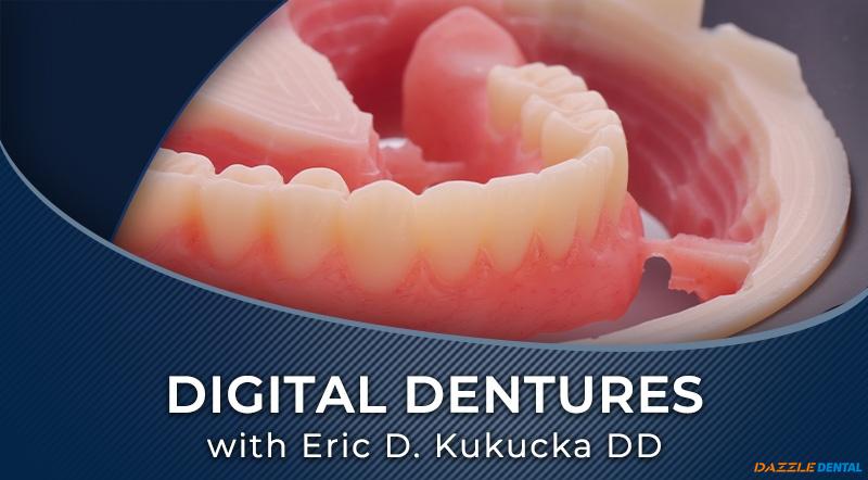 Digital Dentures – Clinical Workflow Overview