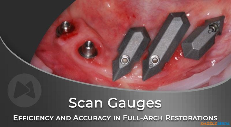 Efficiency and Accuracy in Full-Arch Implant Restorations from Planning to Delivery
