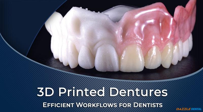 Efficient 3D Printed Digital Denture Workflows for Dentists