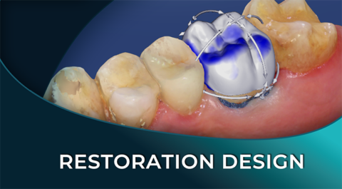 Fundamentals of CAD/CAM Design | Medit Australia: The Easy Entry into ...