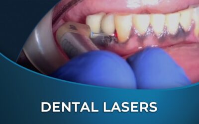 Hard Tissue Lasers: Overview and Clinical Applications in Dentistry