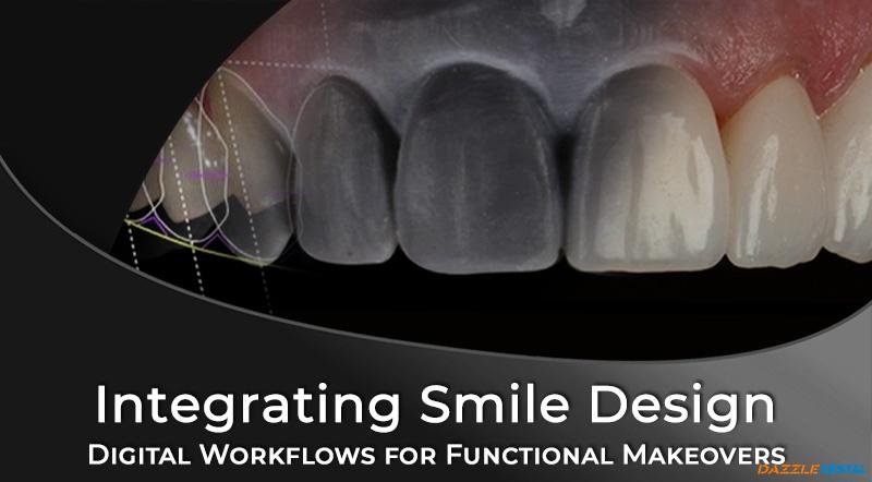 Integrating Digital Smile Design for Functional Makeovers