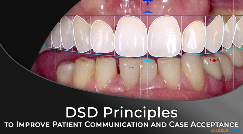 Principles of Digital Smile Design
